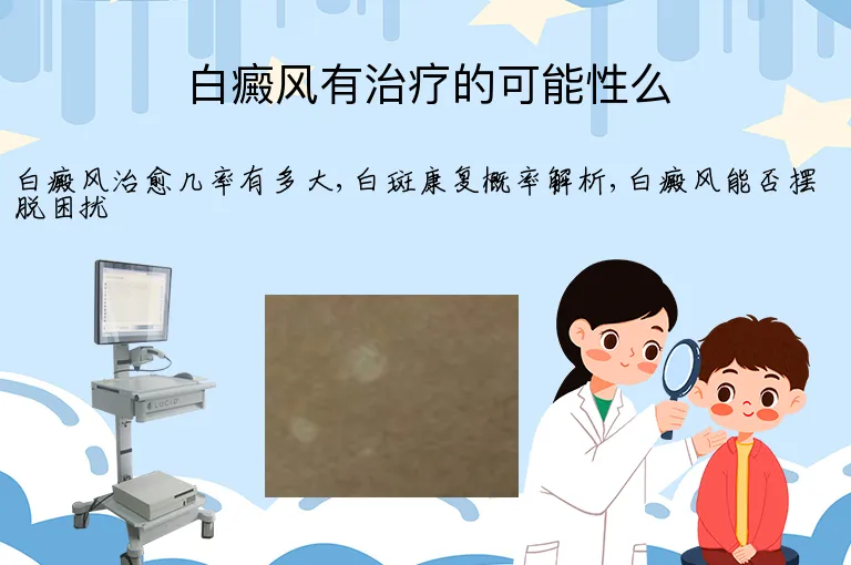 白癜风有治疗的可能性么