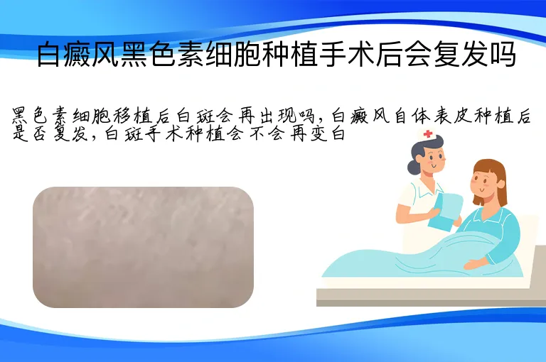 白癜风黑色素细胞种植手术后会复发吗