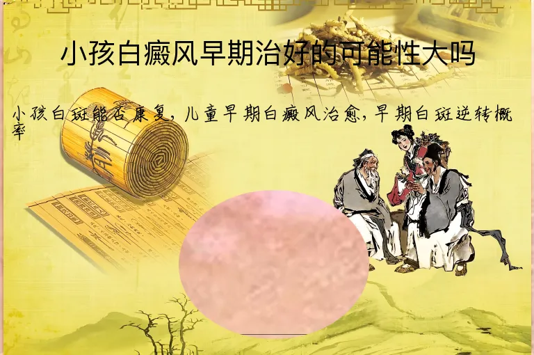 小孩白癜风早期治好的可能性大吗
