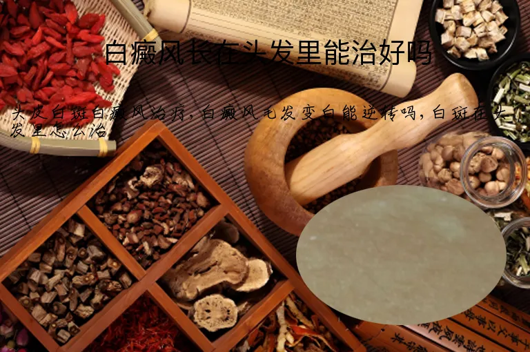 白癜风长在头发里能治好吗