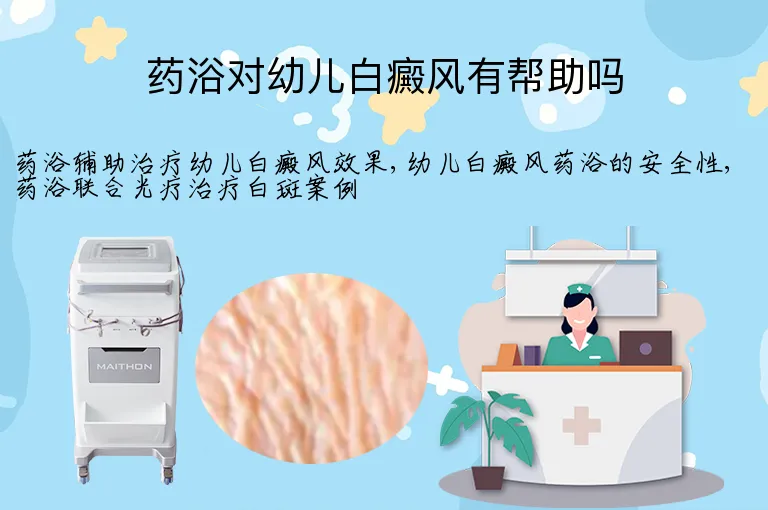 药浴对幼儿白癜风有帮助吗