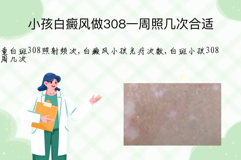 小孩白癜风做308一周照几次合适