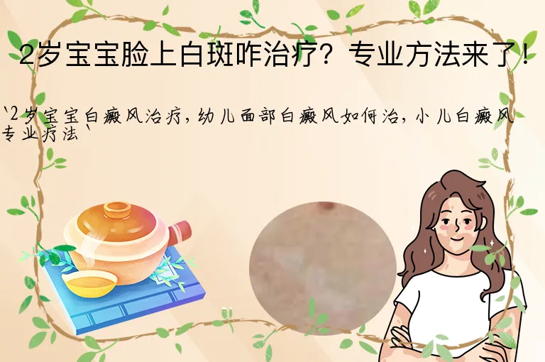 2岁宝宝脸上白斑咋治疗？专业方法来了！
