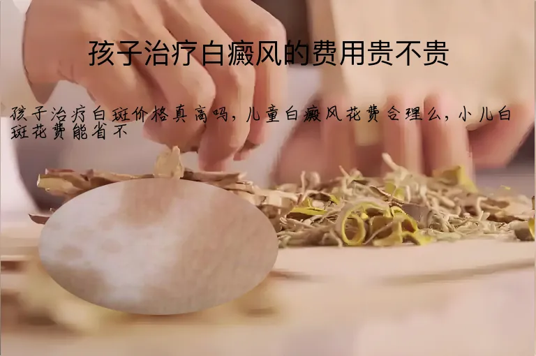 孩子治疗白癜风的费用贵不贵