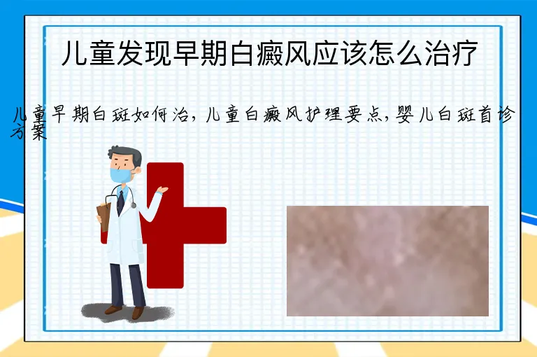 儿童发现早期白癜风应该怎么治疗