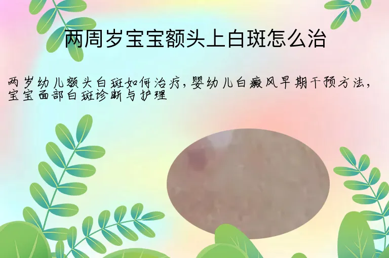 两周岁宝宝额头上白斑怎么治