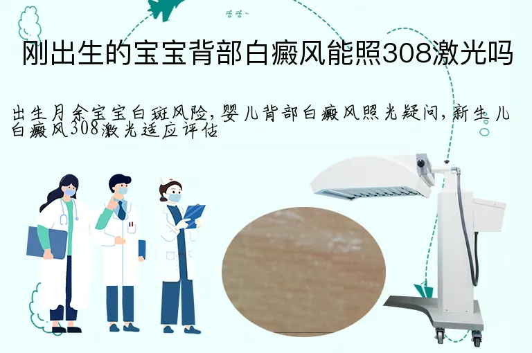 刚出生的宝宝背部白癜风能照308激光吗