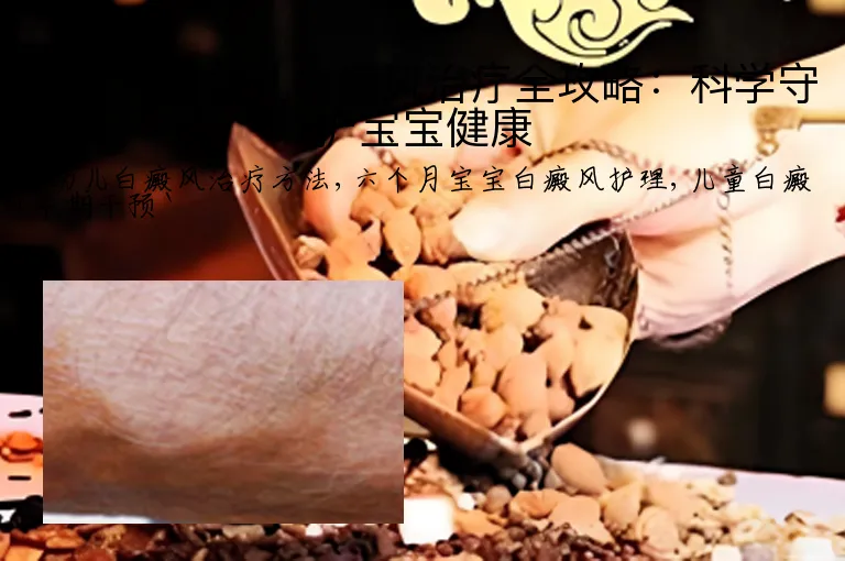 六个月婴幼儿白癜风治疗全攻略：科学守护宝宝健康