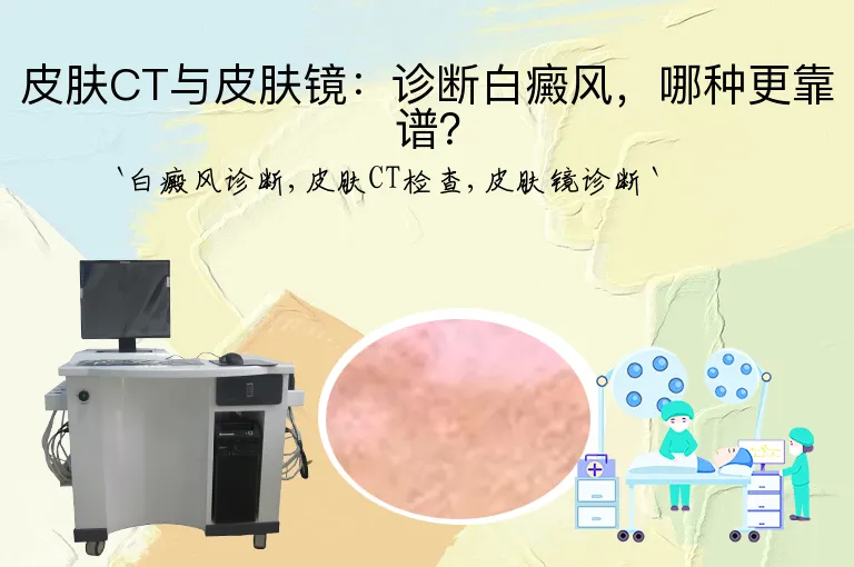 皮肤CT与皮肤镜：诊断白癜风，哪种更靠谱？