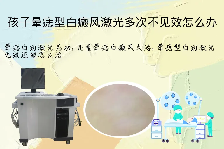 孩子晕痣型白癜风激光多次不见效怎么办