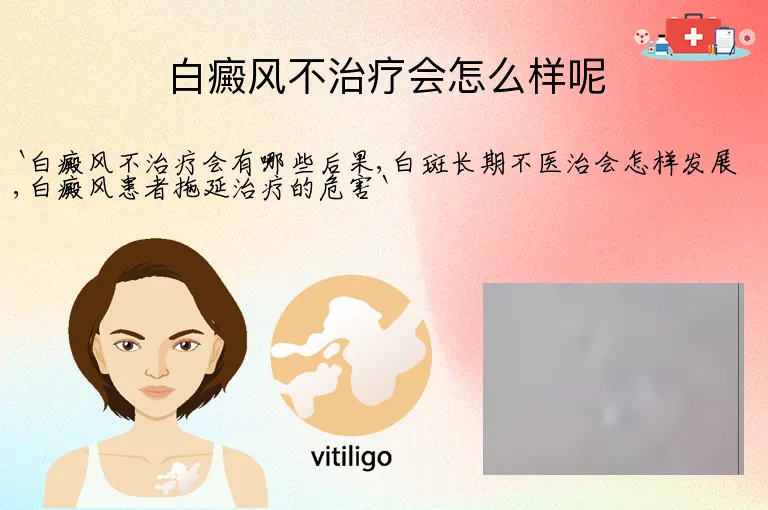 白癜风不治疗会怎么样呢