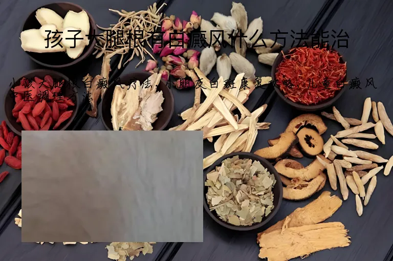 孩子大腿根有白癜风什么方法能治