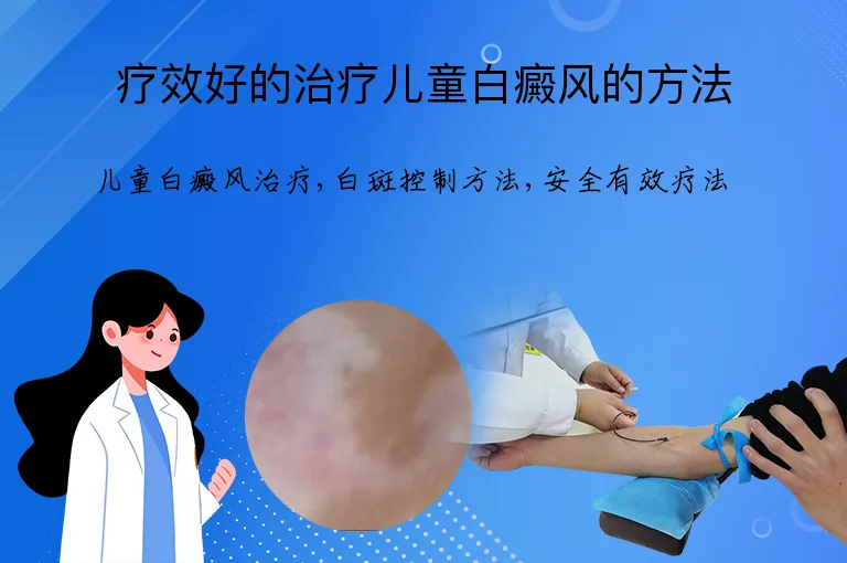 疗效好的治疗儿童白癜风的方法