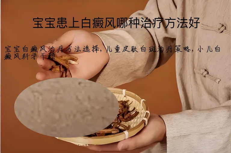 宝宝患上白癜风哪种治疗方法好