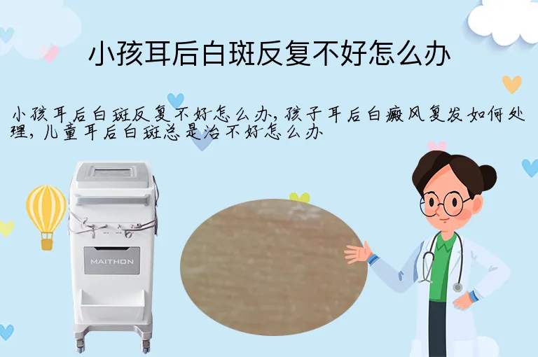 小孩耳后白斑反复不好怎么办