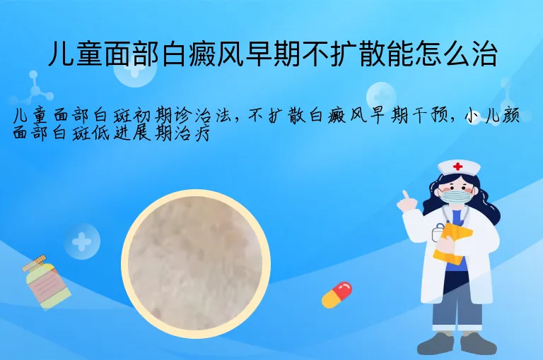 儿童面部白癜风早期不扩散能怎么治