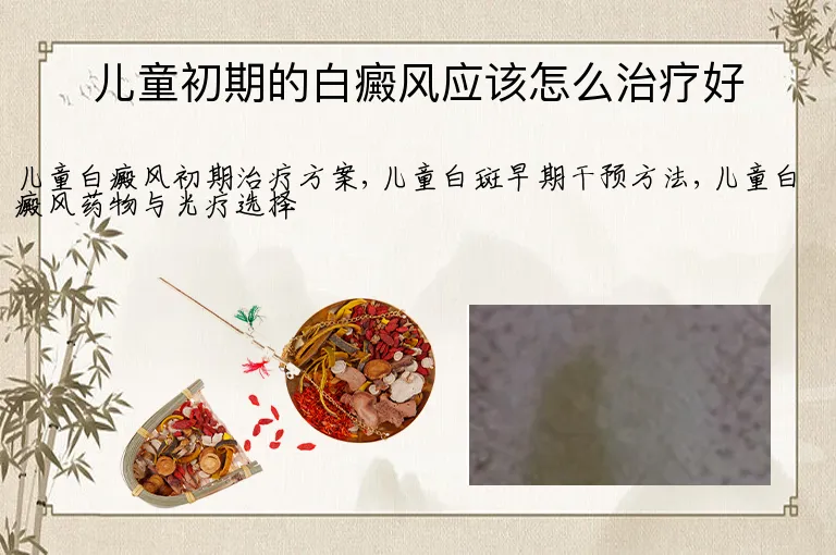 儿童初期的白癜风应该怎么治疗好