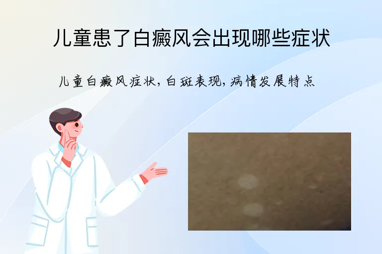 儿童患了白癜风会出现哪些症状