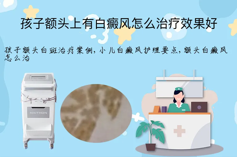 孩子额头上有白癜风怎么治疗效果好