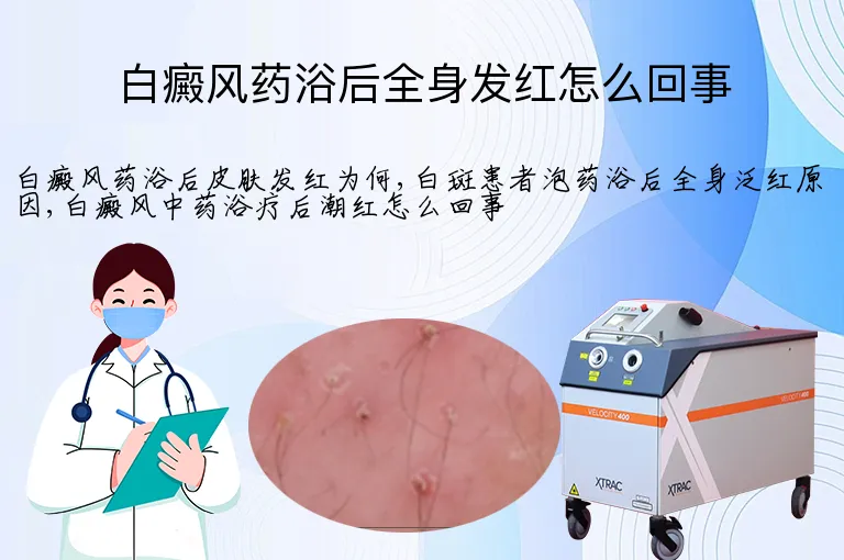 白癜风药浴后全身发红怎么回事