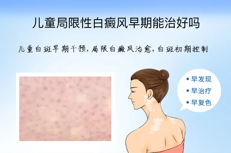 儿童局限性白癜风早期能治好吗