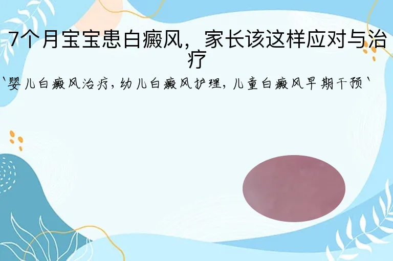 7个月宝宝患白癜风，家长该这样应对与治疗