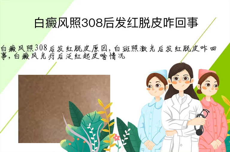 白癜风照308后发红脱皮咋回事