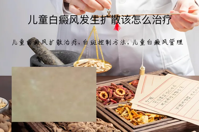 儿童白癜风发生扩散该怎么治疗