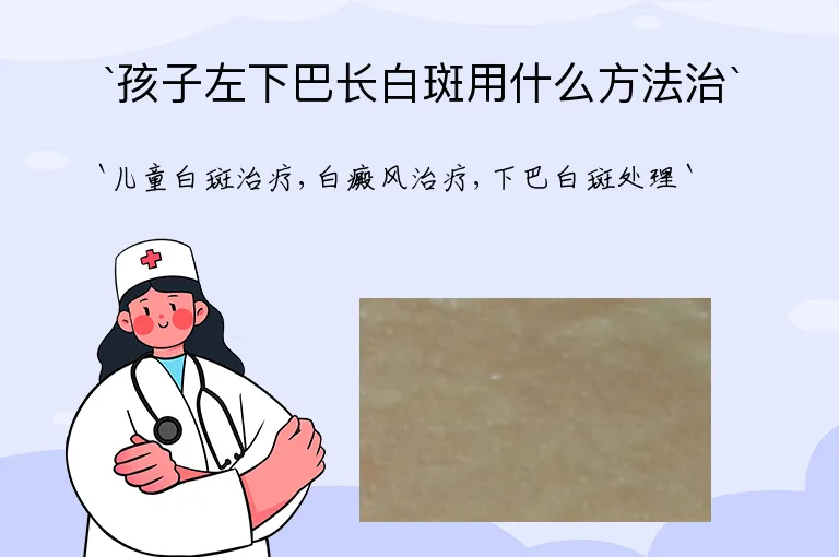 孩子左下巴长白斑用什么方法治