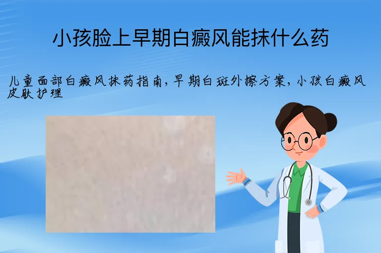 小孩脸上早期白癜风能抹什么药