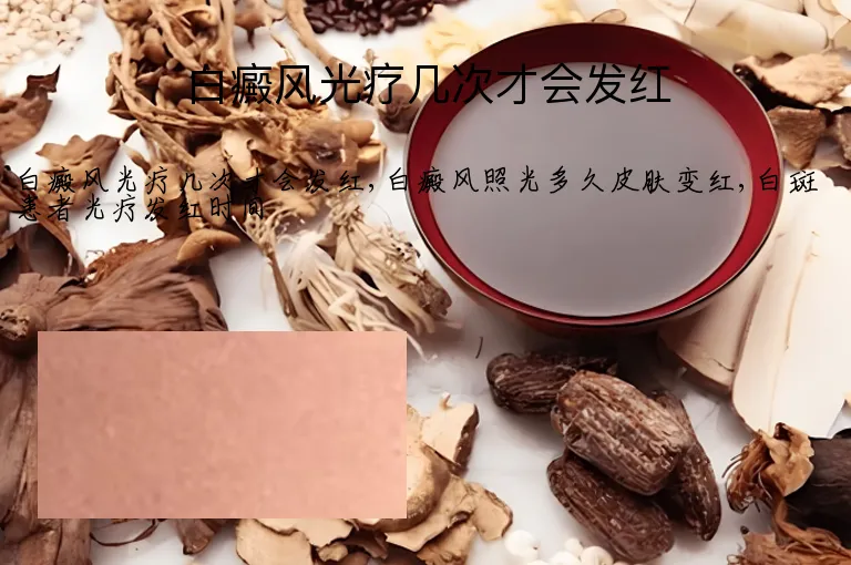 白癜风光疗几次才会发红