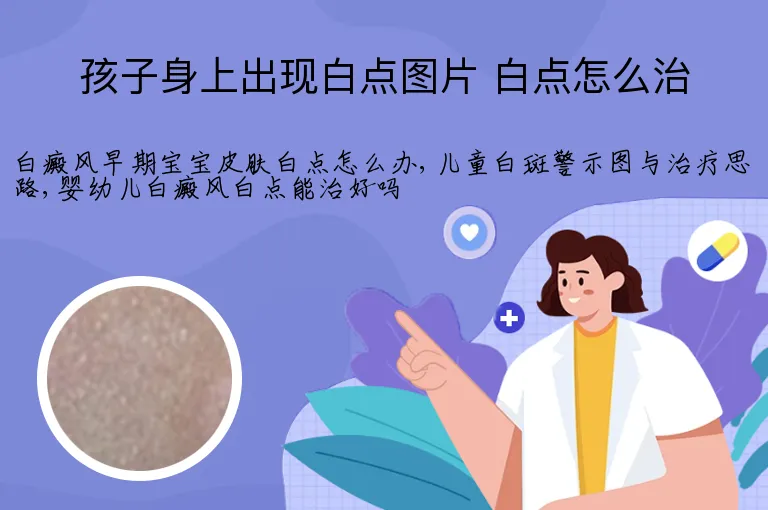 孩子身上出现白点图片 白点怎么治
