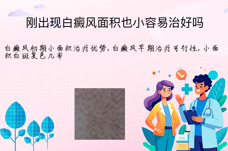 刚出现白癜风面积也小容易治好吗
