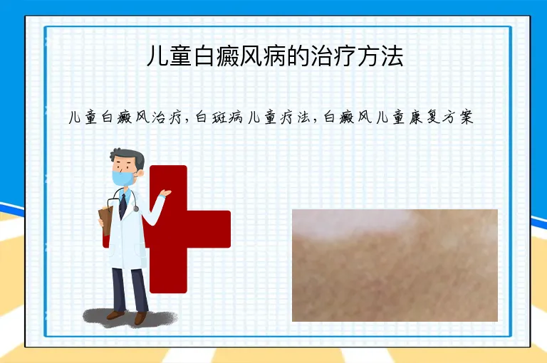 儿童白癜风病的治疗方法