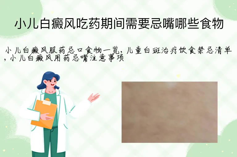 小儿白癜风吃药期间需要忌嘴哪些食物