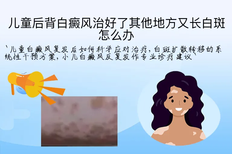 儿童后背白癜风治好了其他地方又长白斑怎么办