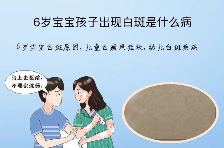 6岁宝宝孩子出现白斑是什么病