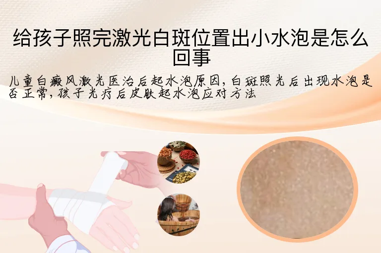 给孩子照完激光白斑位置出小水泡是怎么回事