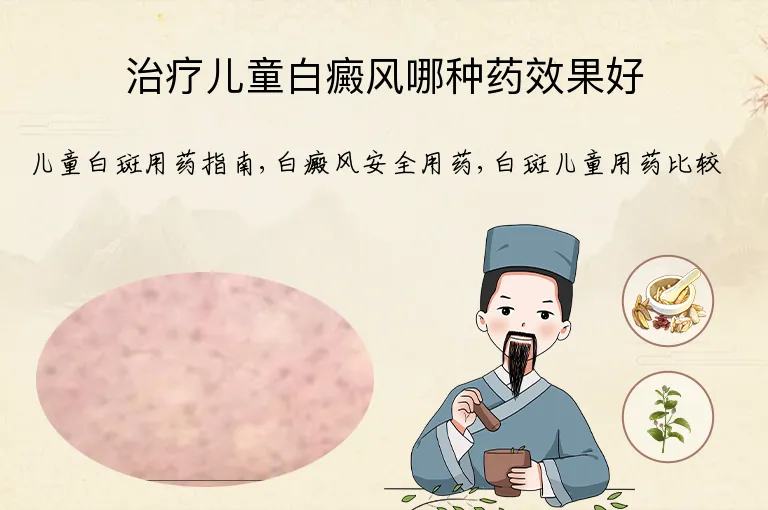 治疗儿童白癜风哪种药效果好