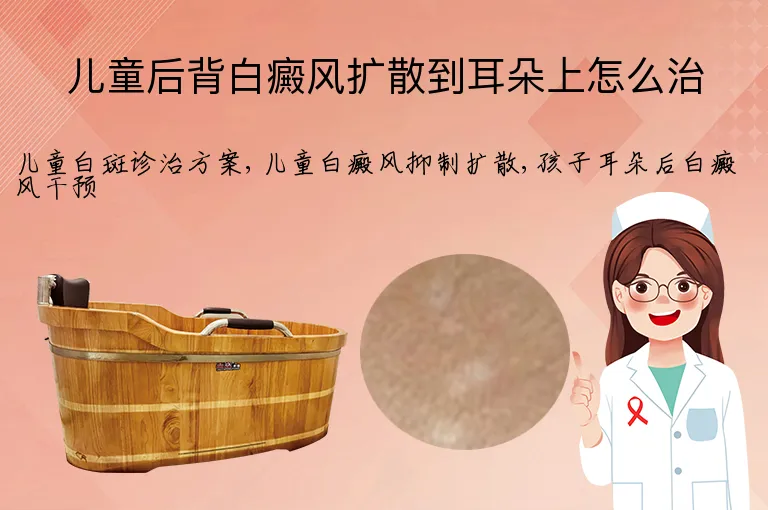 儿童后背白癜风扩散到耳朵上怎么治