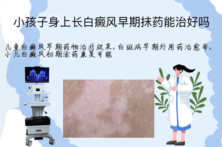 小孩子身上长白癜风早期抹药能治好吗