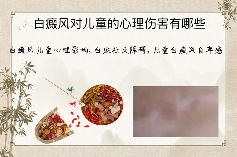 白癜风对儿童的心理伤害有哪些