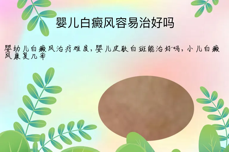 婴儿白癜风容易治好吗