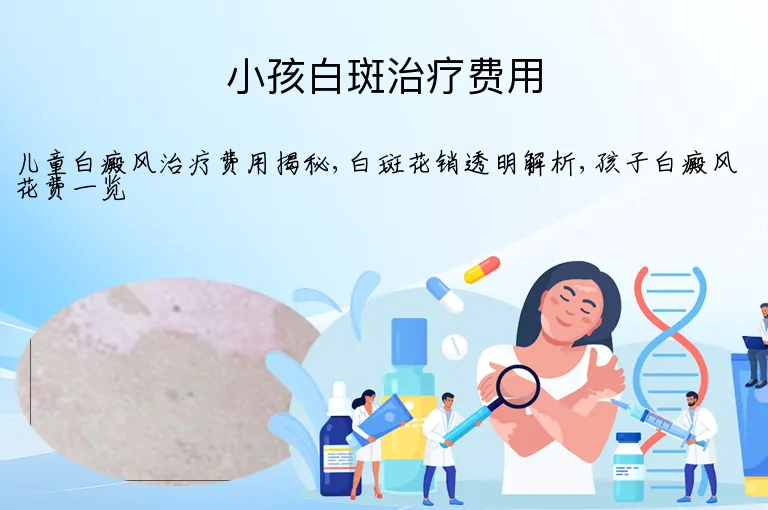 小孩白斑治疗费用