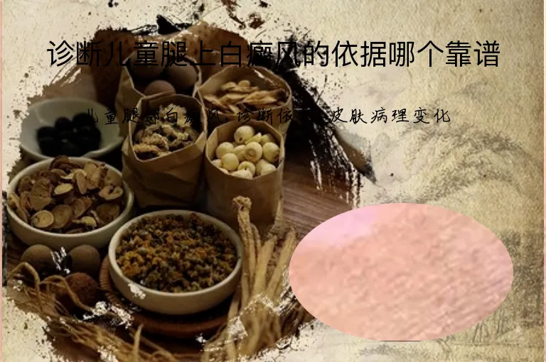 诊断儿童腿上白癜风的依据哪个靠谱