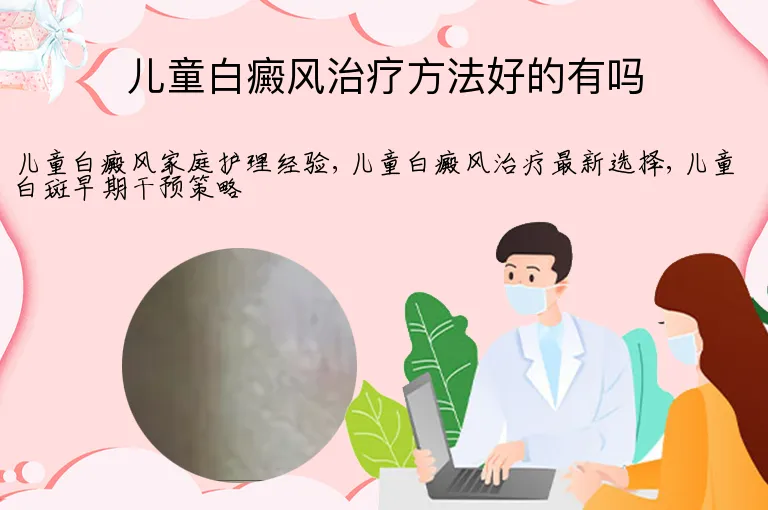 儿童白癜风治疗方法好的有吗