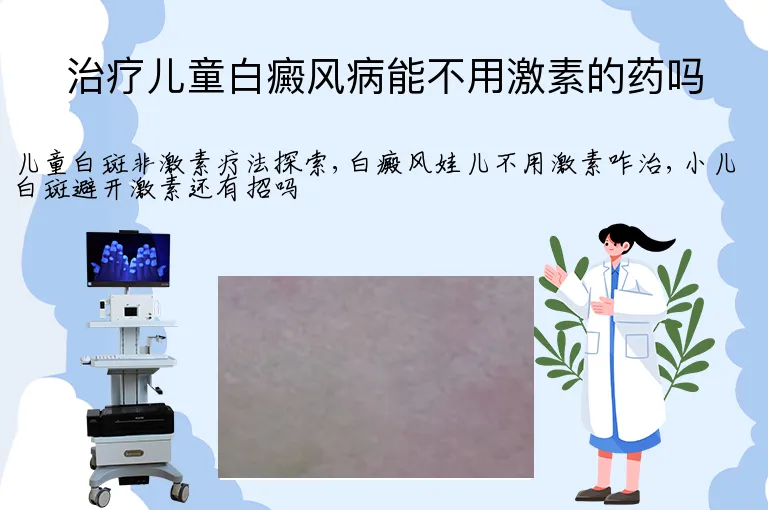 治疗儿童白癜风病能不用激素的药吗