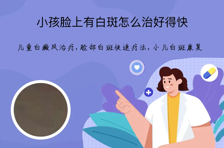小孩脸上有白斑怎么治好得快