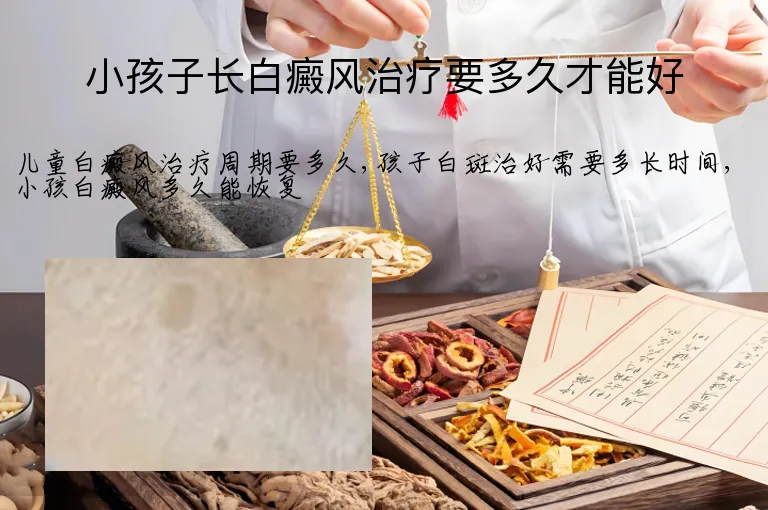 小孩子长白癜风治疗要多久才能好