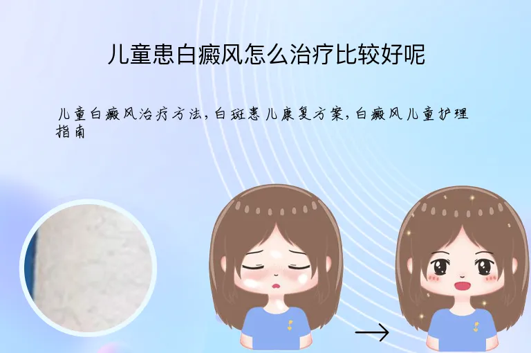 儿童患白癜风怎么治疗比较好呢